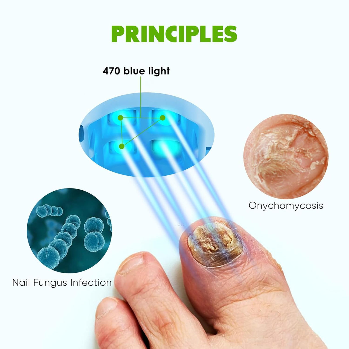 Blue Light for Nail Fungus Q866