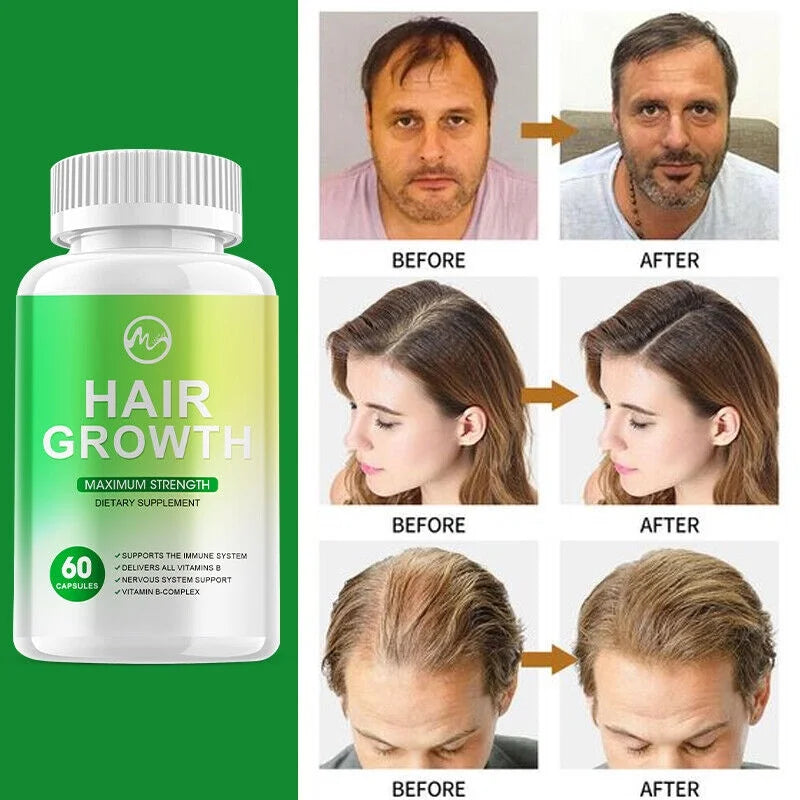 Hair Growth Vitamins 60 Capsules C641