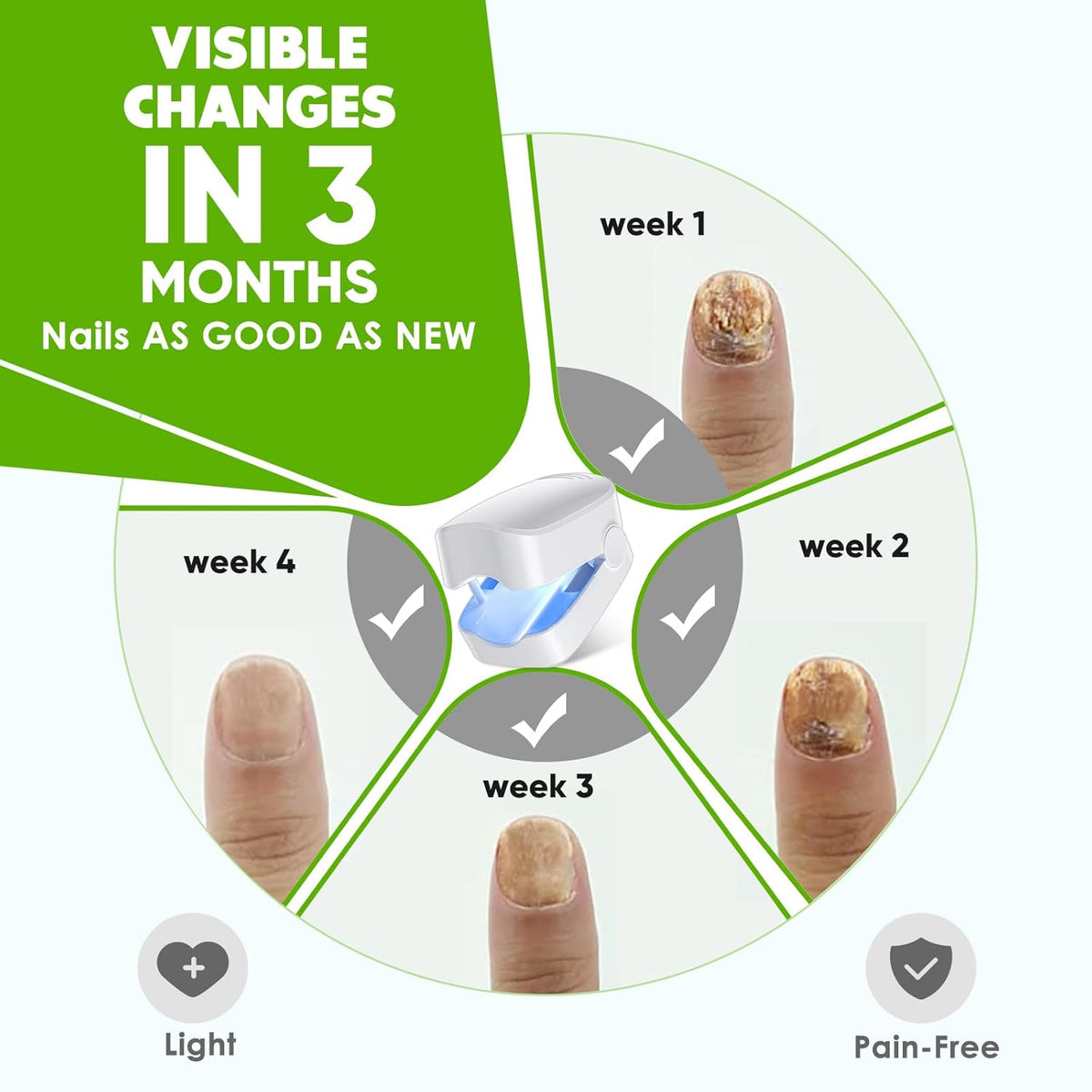 Blue Light for Nail Fungus Q866